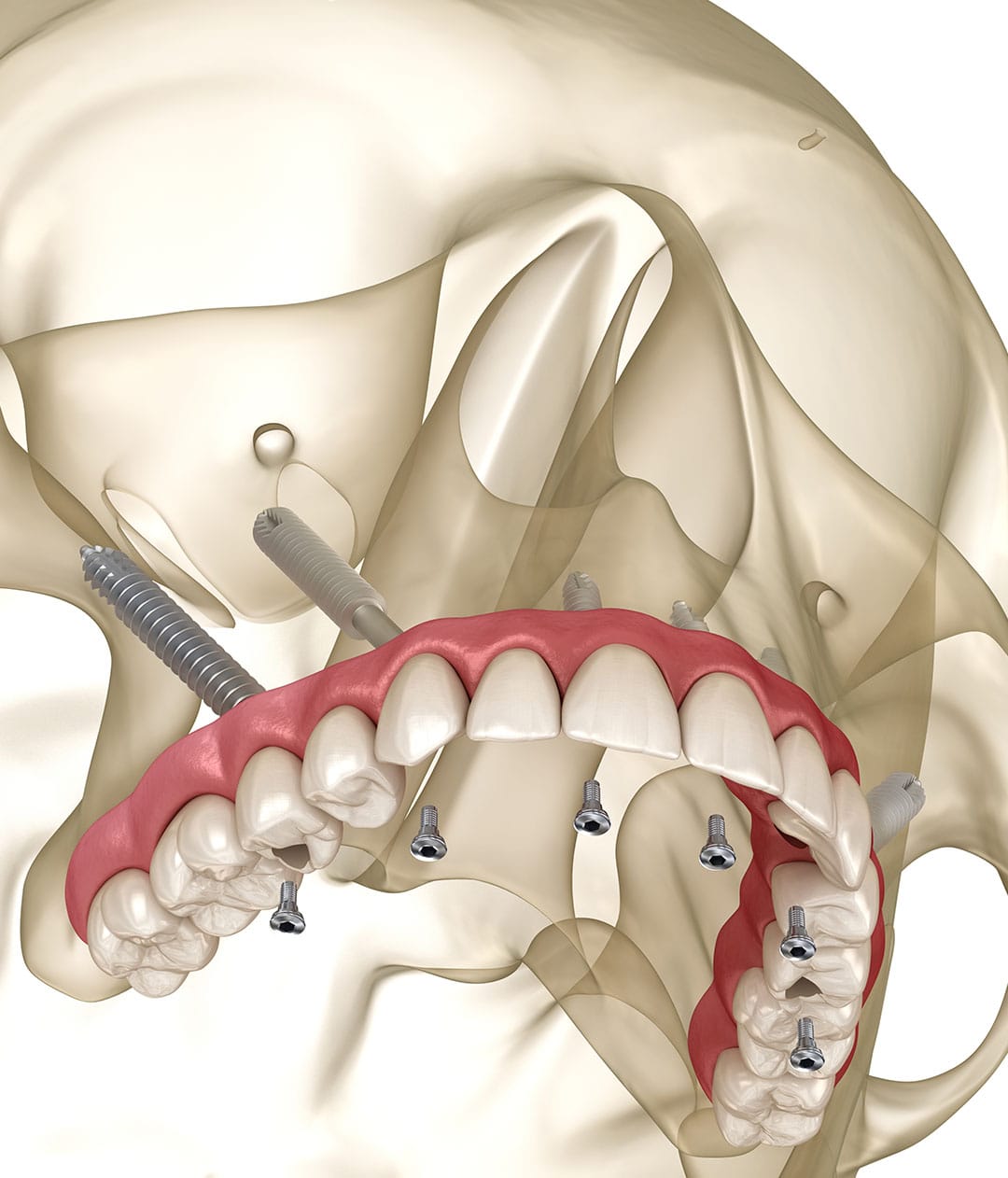 お値下げ相談可能！MAXILLA-ORIENTED IMPLANTOLOGY Maxilla